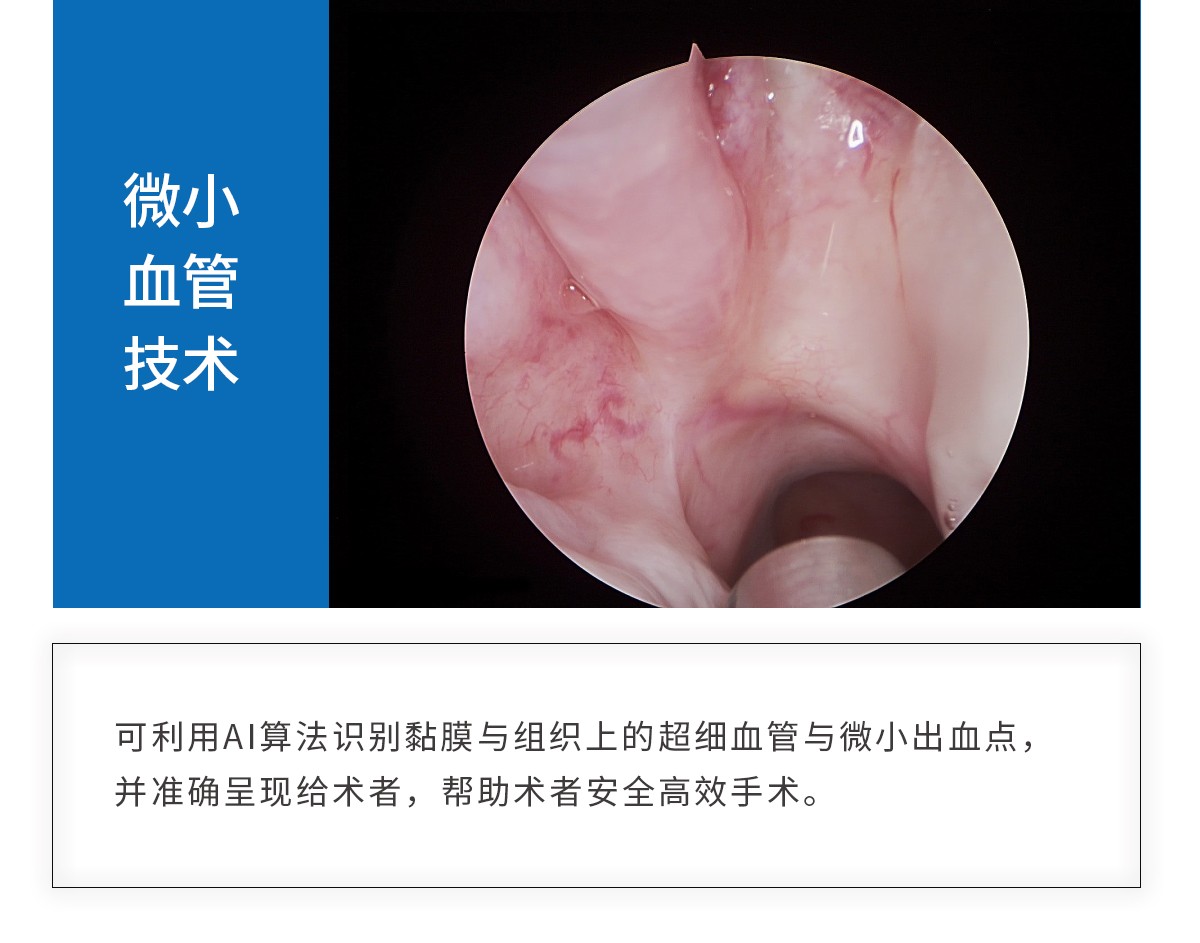 【4K醫(yī)用內(nèi)窺鏡攝像系統(tǒng)】您的第一臺(tái)“4K”找到了嗎？