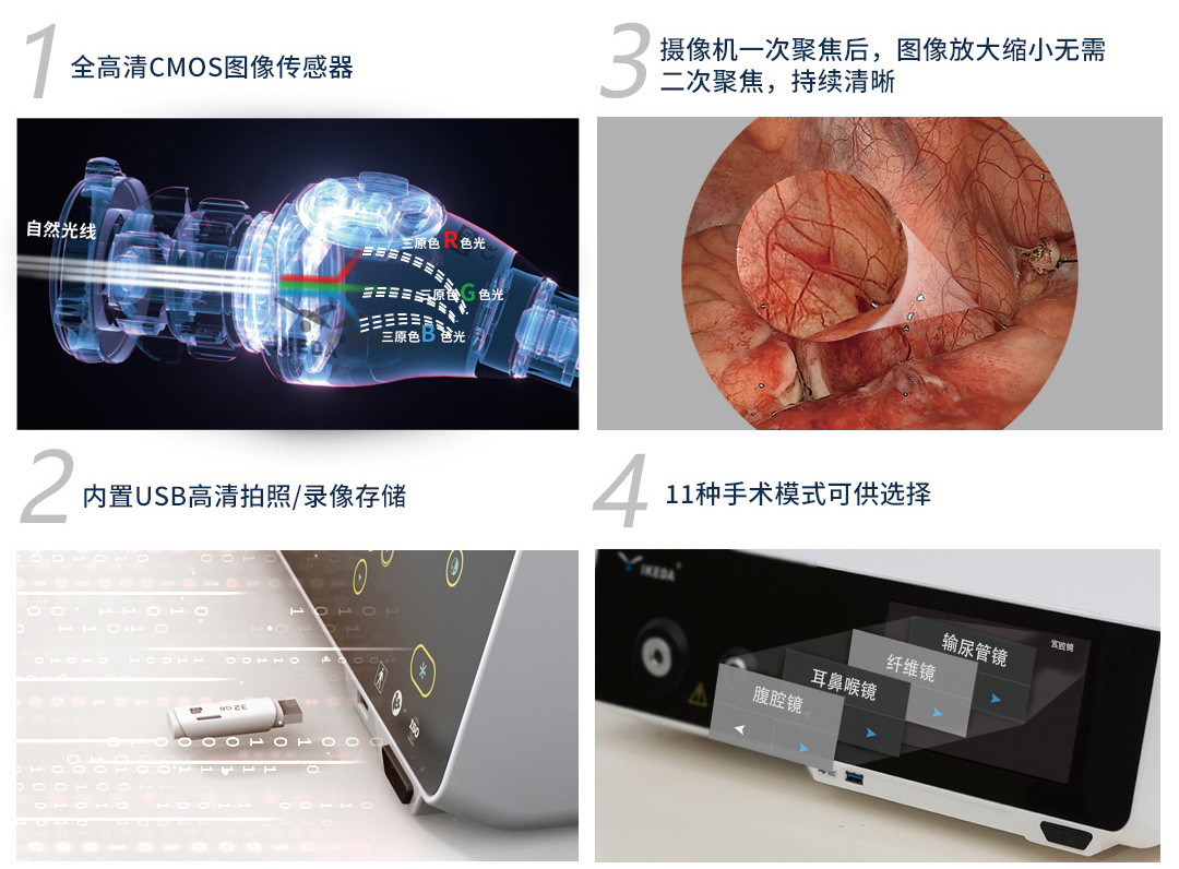 YKD-9105 一體化內窺鏡影像系統