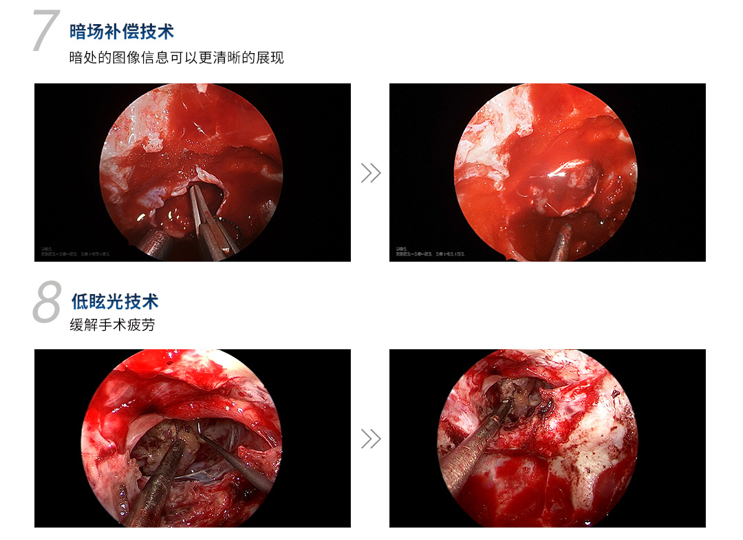 4K醫(yī)用內(nèi)窺鏡攝像系統(tǒng) YKD-9210