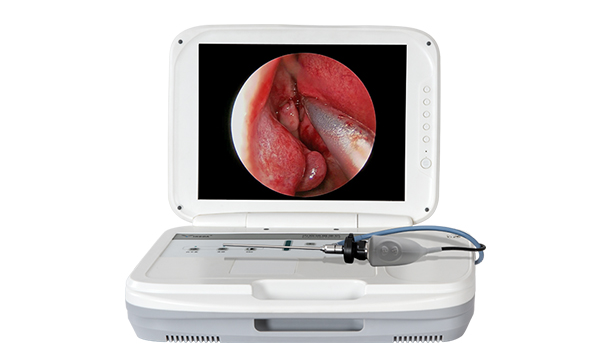 鼻內窺鏡是檢查什么的？需要注意哪些？